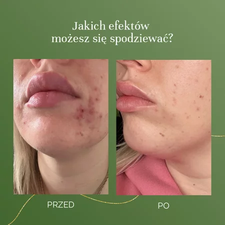 MyBestComplement koncentrat wspomagający odnowę i regenerację 250 ml