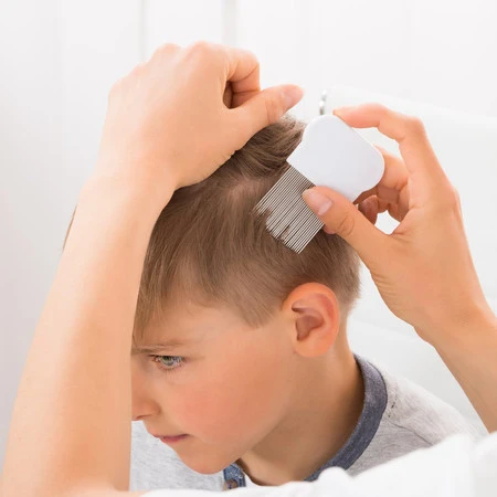 Alphanova Kids, ZEROPOU, Balsam przeciw wszom i gnidom, 100 ml