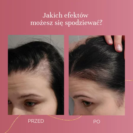MyBestBeauty suplement na poprawę kondycji włosów, skóry i paznokci 90 kaps.