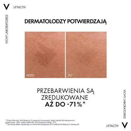 Vichy − Liftactiv Specialist B3, serum do twarzy − 30 ml