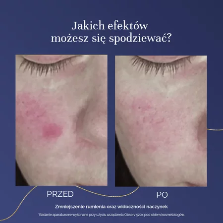 MyBestCollaGEN suplement na wsparcie kondycji skóry 150 kaps.